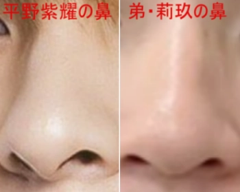 平野紫耀と弟・平野莉玖（りく）の鼻の比較画像